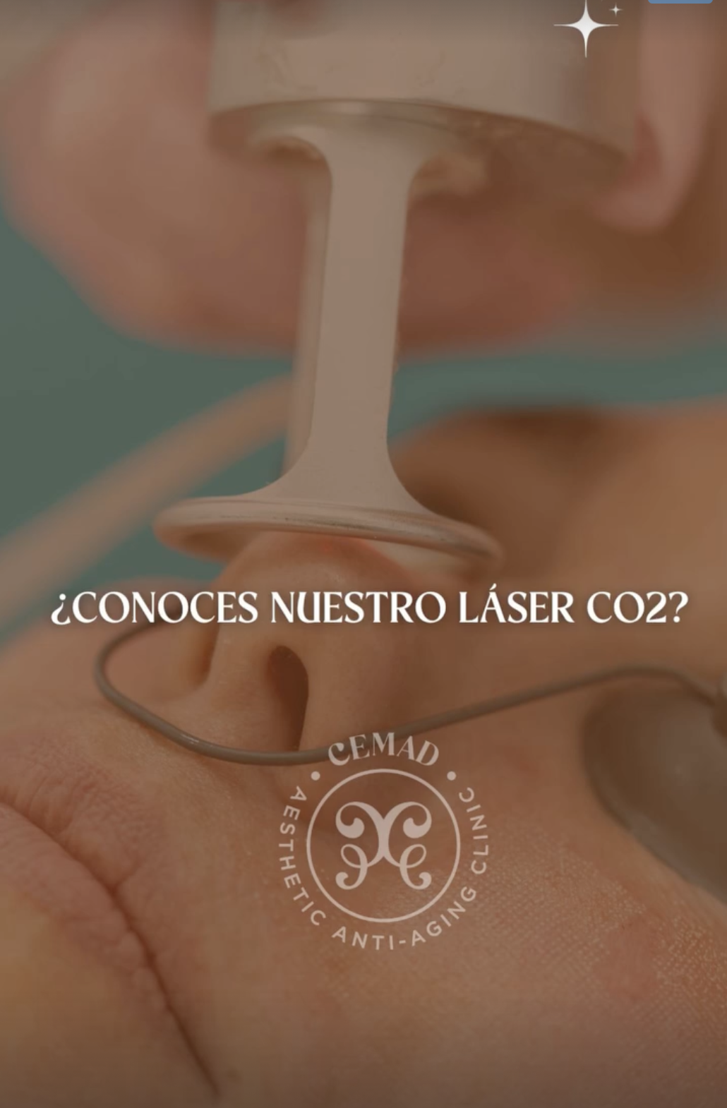 Laserterapia CO₂ fraccionada · CEMAD Aesthetic Anti-Aging Clinic