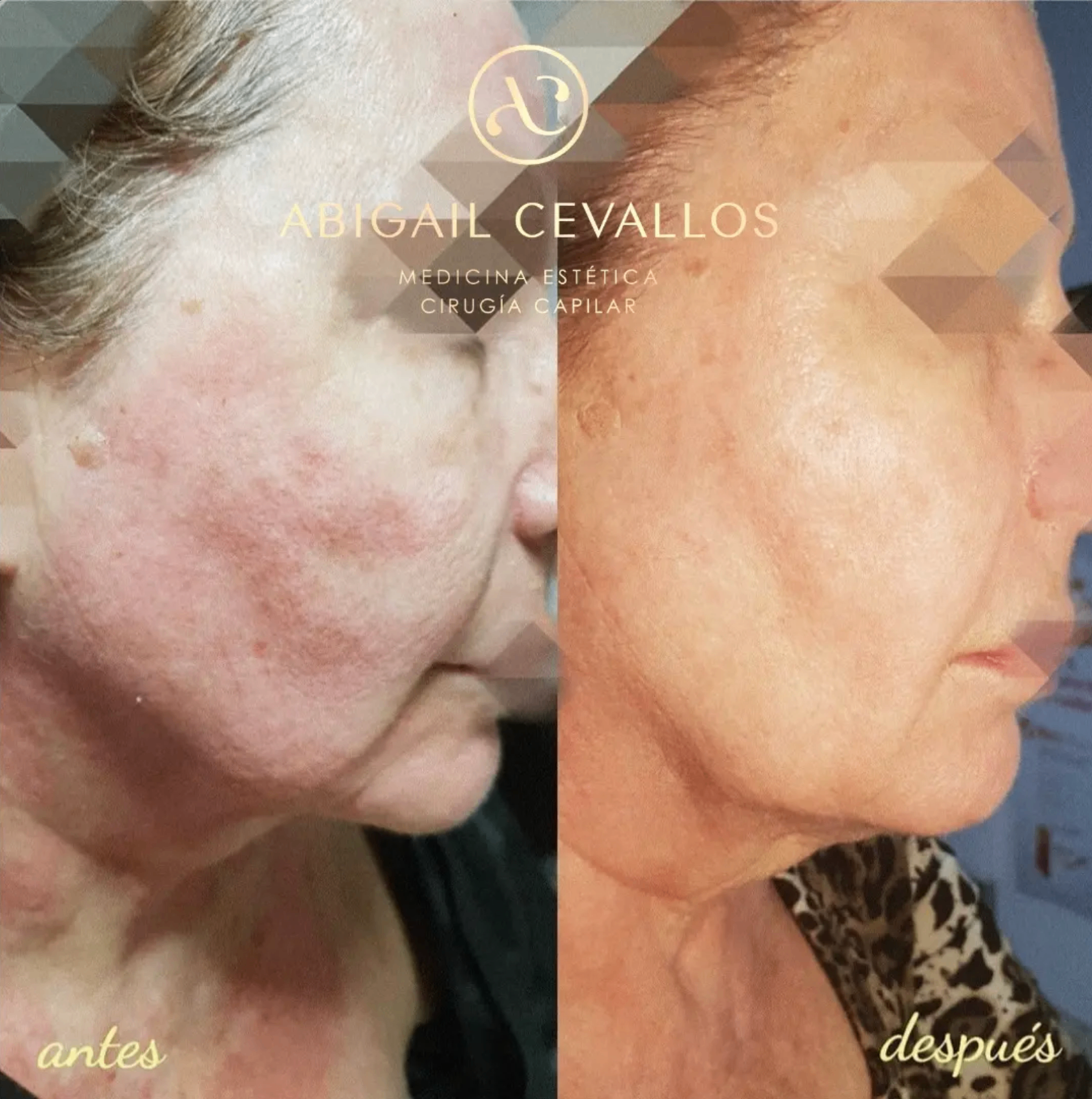 Diagnóstico biológico · resultado antes y después · Dra. Abigail Cevallos