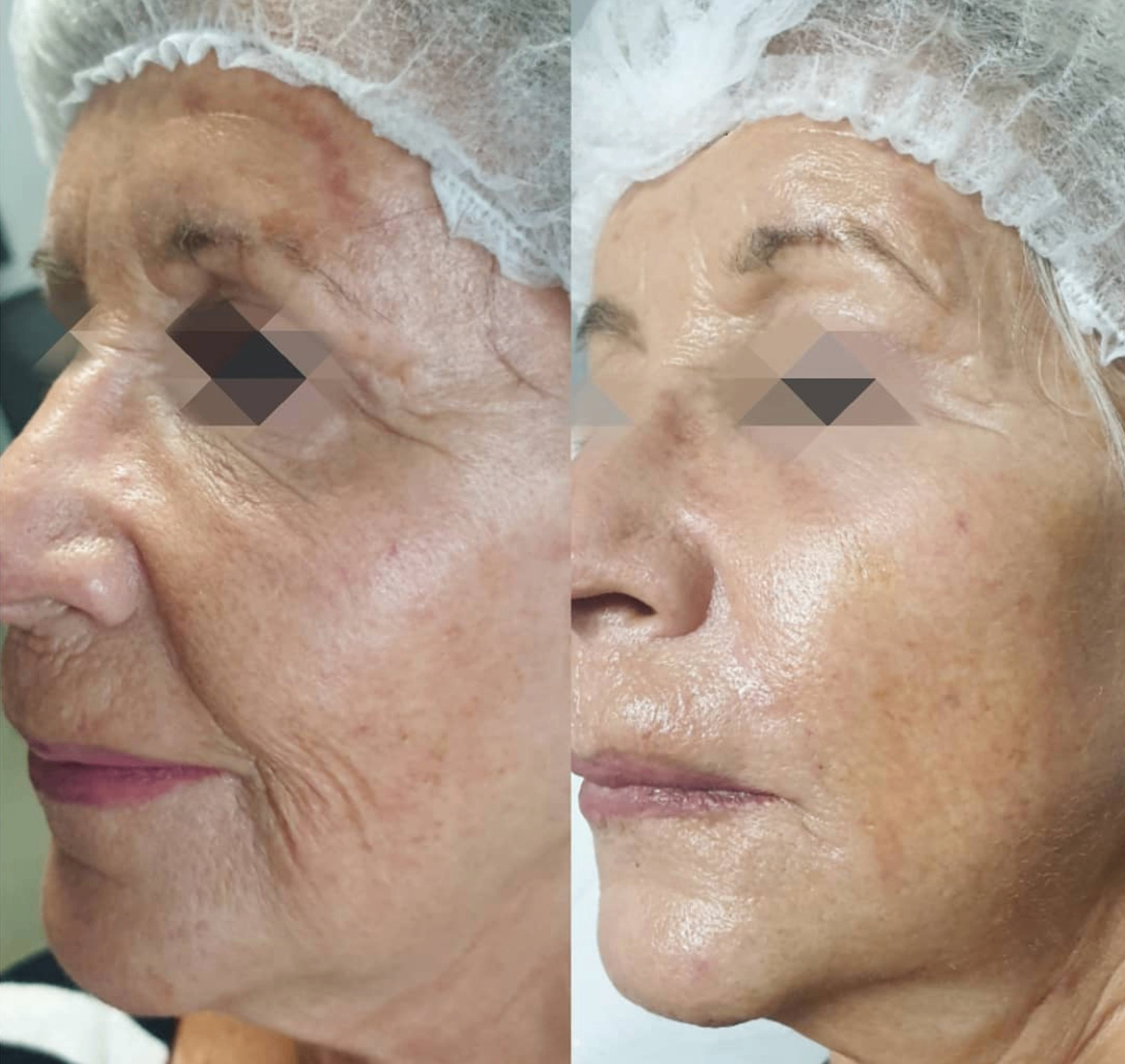IV Therapy · resultado antes y después · Dra. Abigail Cevallos