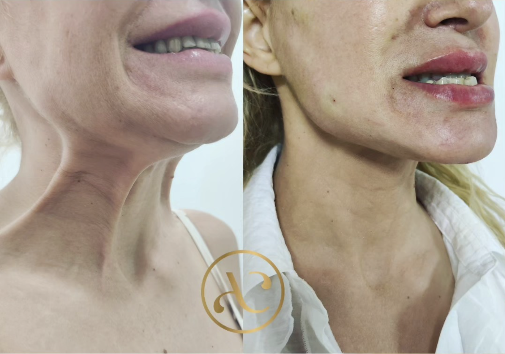 Reprogramación biomolecular · resultado antes y después · Dra. Abigail Cevallos